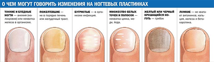 Грибковое заболевание кожи и ногтей фото Грибковое заболевание кожи и ногтей фото